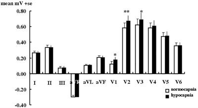 Hypocapnia Alone Fails to Provoke Important Electrocardiogram Changes in Coronary Artery Diseased Patients